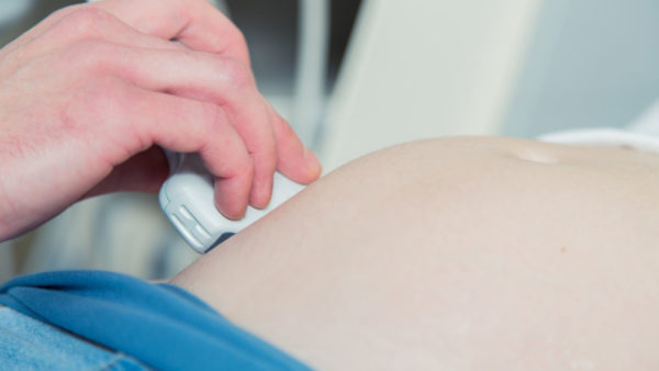 Combinatietest (nekplooimeting en serumscreening)